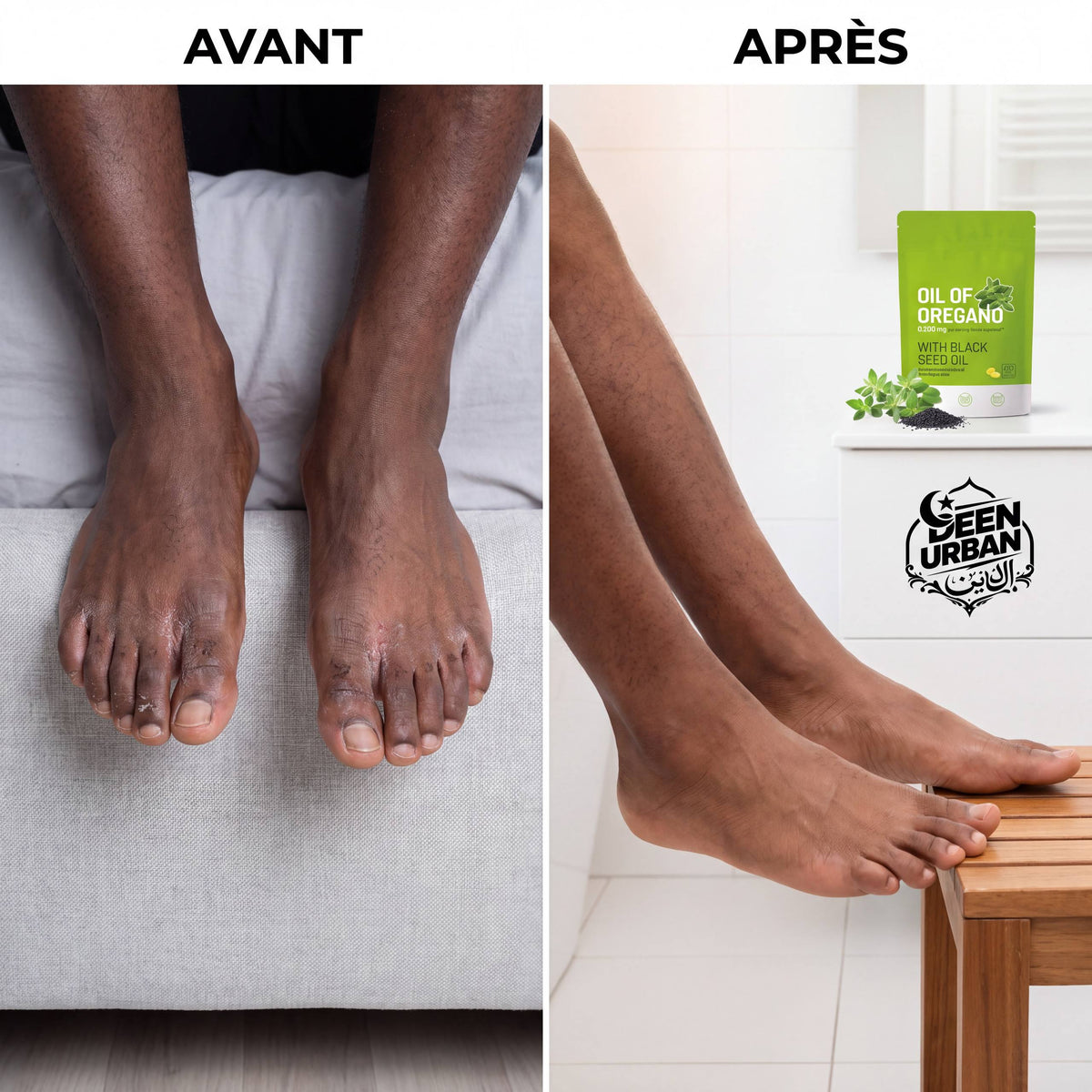 Capsule origan nigelle bien-être
