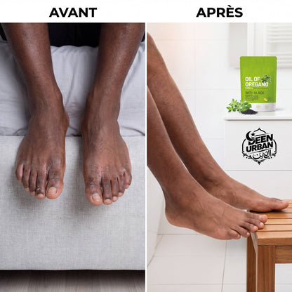 Capsule origan nigelle bien-être